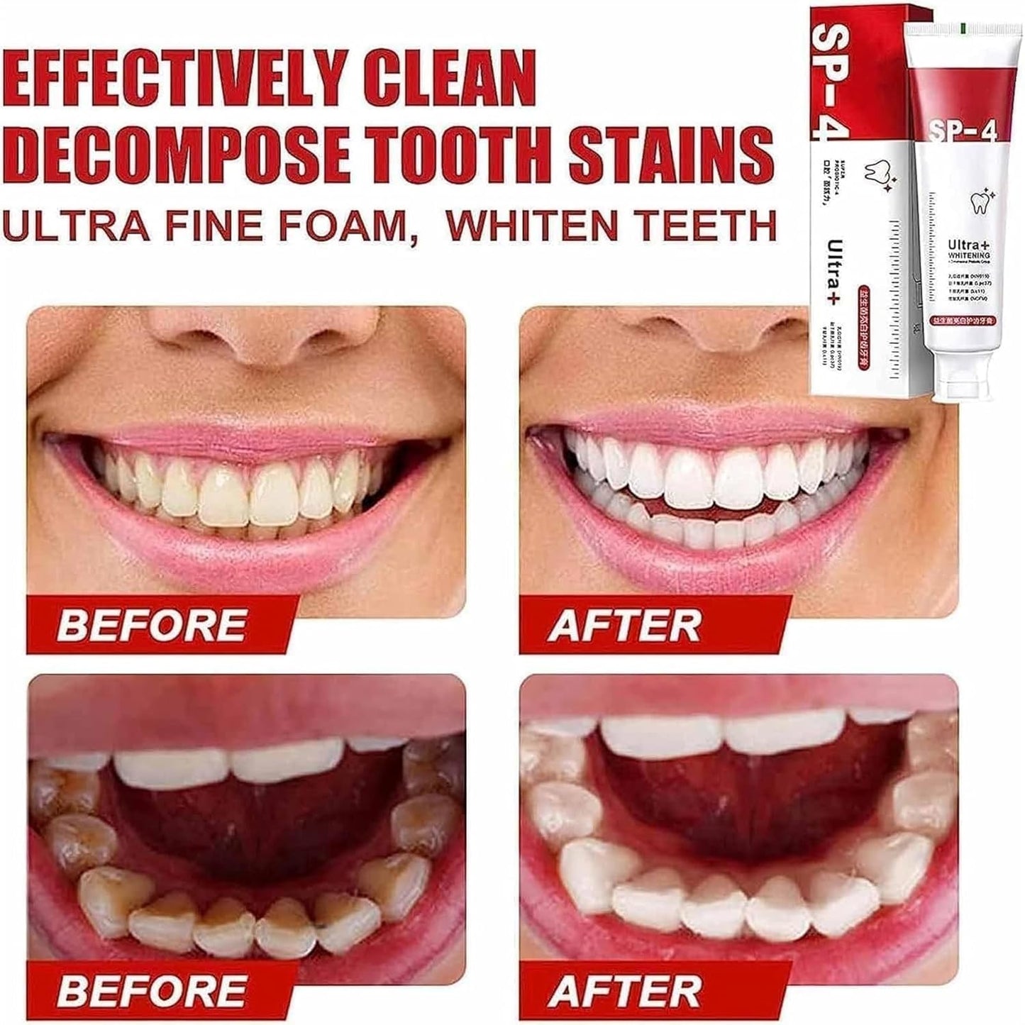 Yayashi Sp-4 Ultra Whitening Toothpaste Probiotic Stain Remover / Stain Removing Toothpaste, Protects Gums Freshens Breath, for Everyone (Orignal) Made In China